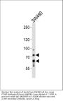Anti-PCSK9 Antibody (N-term)