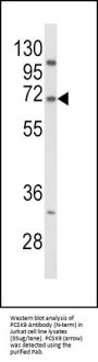 Anti-PCSK9 Antibody (N-term)