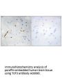 Anti-TCF3/E2A Antibody
