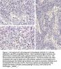 Anti-IL-1 beta Antibody