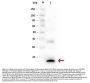 Anti-IL-1 beta Antibody