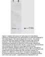Anti-IL-1 beta Antibody
