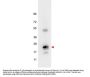 Anti-IL-6 Antibody