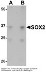 Anti-Transcription factor SOX-2 SOX2 Antibody