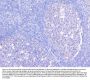 Anti-BCL6 Antibody Picoband®