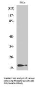 Anti-Phospho-p21 (T145) CDKN1A Antibody