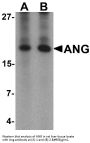 Anti-Angiogenin ANG Antibody