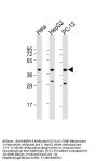 Anti-MAPK14 Antibody (Y323)