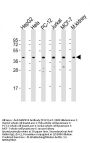 Anti-MAPK14 Antibody (Y323)