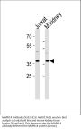 Anti-MAPK14 Antibody (Y323)
