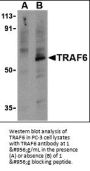 Anti-TRAF6 Antibody