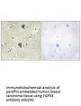 Anti-FGFR3 Antibody