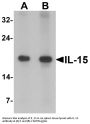 Anti-IL-15 Antibody
