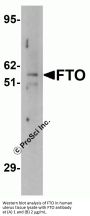 Anti-FTO Antibody