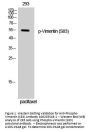 Anti-Phospho-Vimentin (S83) Antibody