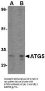 Anti-Autophagy protein 5 ATG5 Antibody