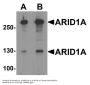 Anti-ARID1A Antibody