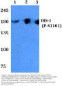 Anti-IRS-1 (phospho-S1101) Antibody