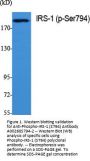 Anti-Phospho-IRS-1 (S794) Antibody