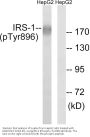 Anti-Phospho-IRS-1 (Y896) Antibody