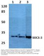 Anti-SOCS-3 Antibody