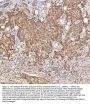 Anti-STIM1 Antibody Picoband®