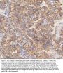 Anti-STIM1 Antibody Picoband®