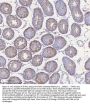 Anti-STIM1 Antibody Picoband®