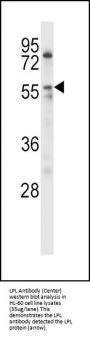 Anti-LPL Antibody (Center)