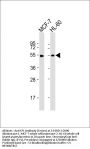 Anti-LPL Antibody (Center)
