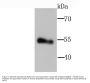 Anti-Lipoprotein lipase LPL Antibody