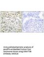 Anti-DNMT3B Antibody