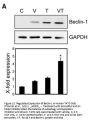 Anti-Beclin-1 BECN1 Antibody