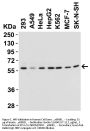 Anti-Beclin-1 BECN1 Antibody