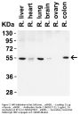 Anti-Beclin-1 BECN1 Antibody