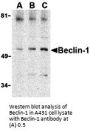 Anti-Beclin-1 BECN1 Antibody