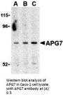 Anti-APG7 ATG7 Antibody