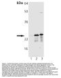 Anti-Mn SOD Sod2 Antibody