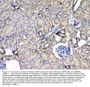 Anti-Leptin Receptor/LEPR Antibody