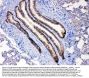Anti-Leptin Receptor/LEPR Antibody