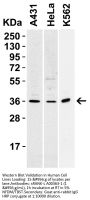 Anti-sRANK Ligand TNFSF11 Antibody