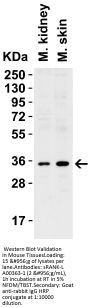 Anti-sRANK Ligand TNFSF11 Antibody