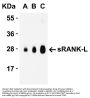 Anti-sRANK Ligand TNFSF11 Antibody