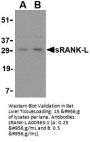Anti-sRANK Ligand TNFSF11 Antibody