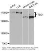Anti-Hamartin TSC1 Antibody