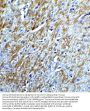 Anti-Survivin BIRC5 Antibody