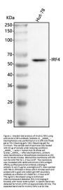Anti-MUM1/IRF4 Antibody Picoband®