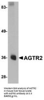 Anti-Type-2 angiotensin II receptor AGTR2 Antibody