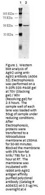 Anti-Angiotensin II Receptor AT2 Agtr2 Antibody