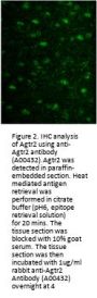 Anti-Angiotensin II Receptor AT2 Agtr2 Antibody
